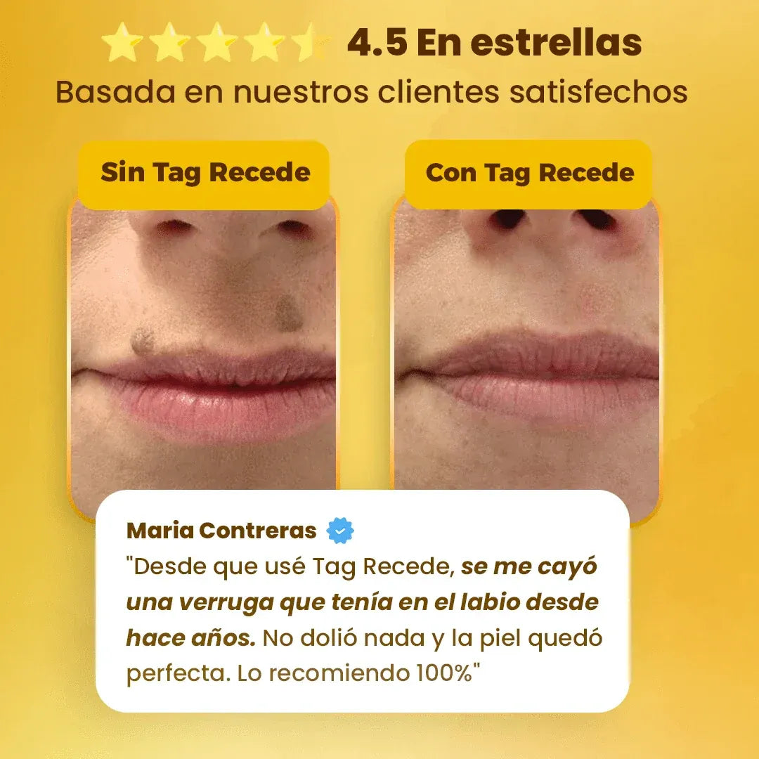 Despídete de las verrugas, lunares y marcas en la piel en 7 días, sin dolor y sin dejar marcas. 🐝