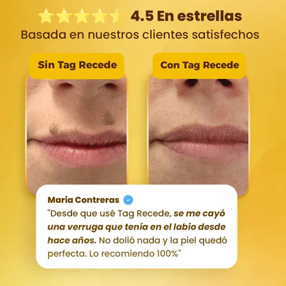 Despídete de las verrugas, lunares y marcas en la piel en 7 días, sin dolor y sin dejar marcas. 🐝